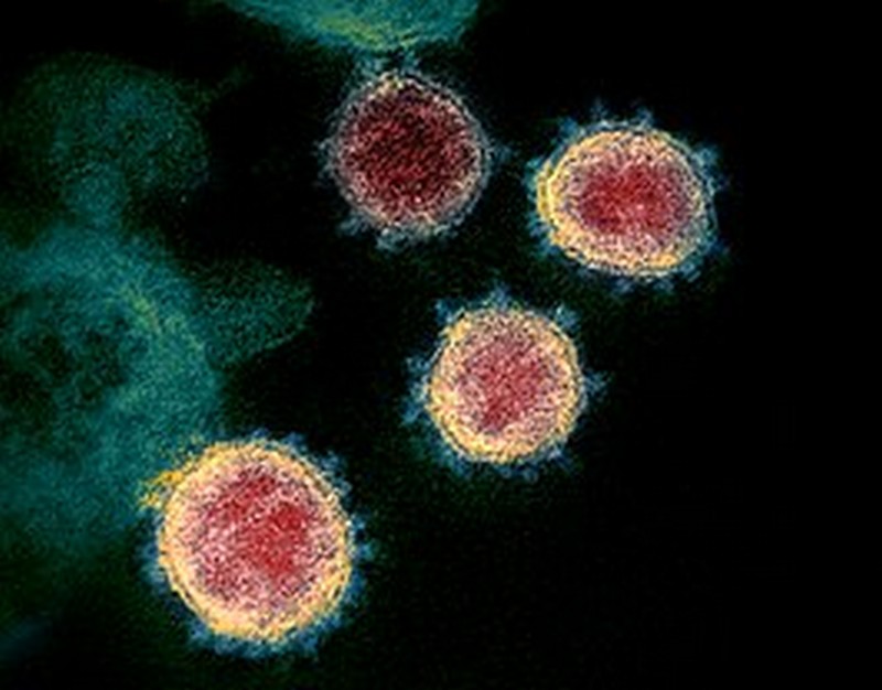 SRAS 2.0 |  Se han creado virus y bacterias mortales en laboratorios.  Zestradar