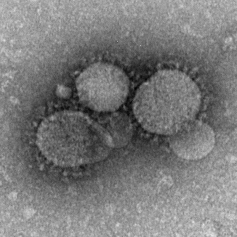 Híbrido MERS-Rabia |:  Se han creado virus y bacterias mortales en laboratorios.  Zestradar