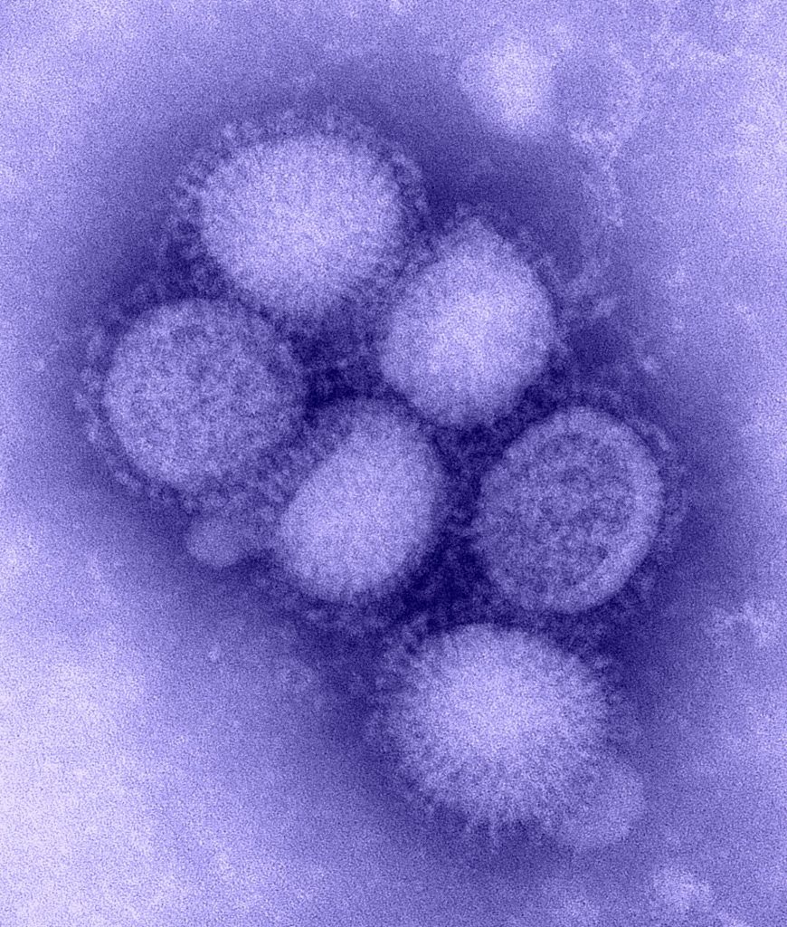 H1N1  Se han creado virus y bacterias mortales en laboratorios.  Zestradar